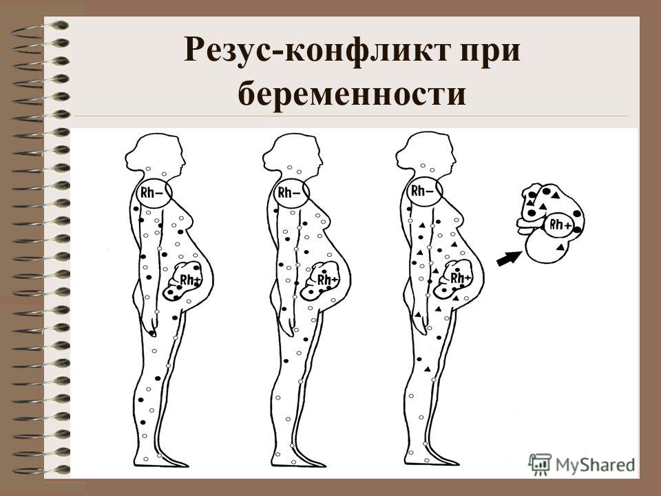 как может проявится резус конфликт на 17 неделе как может проявится резус конфликт на 17 неделе