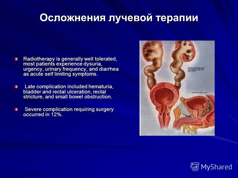 Классификация