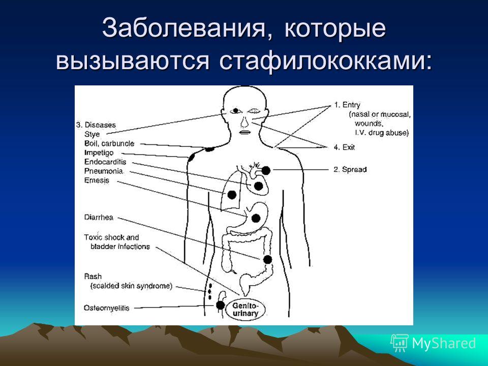 Стрептококк проявление на коже Стрептококк проявление на коже