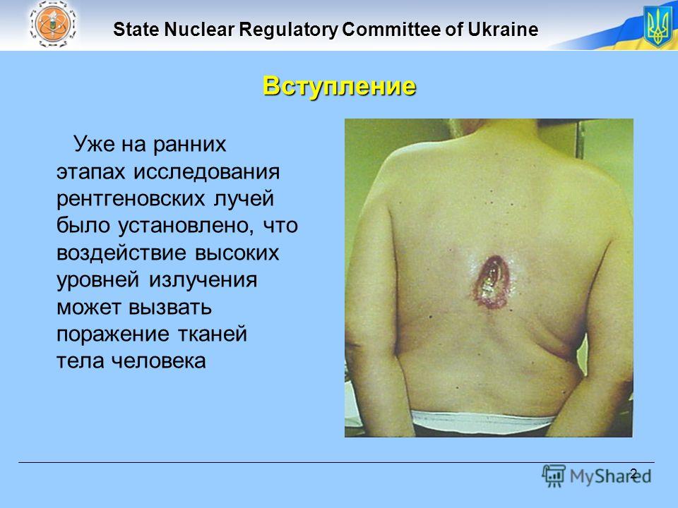 State Nuclear Regulatory Committee of Ukraine 2 Уже на ранних этапах исследования рентгеновских лучей было установлено, что воздействие высоких уровней излучения может вызвать поражение тканей тела человека Вступление