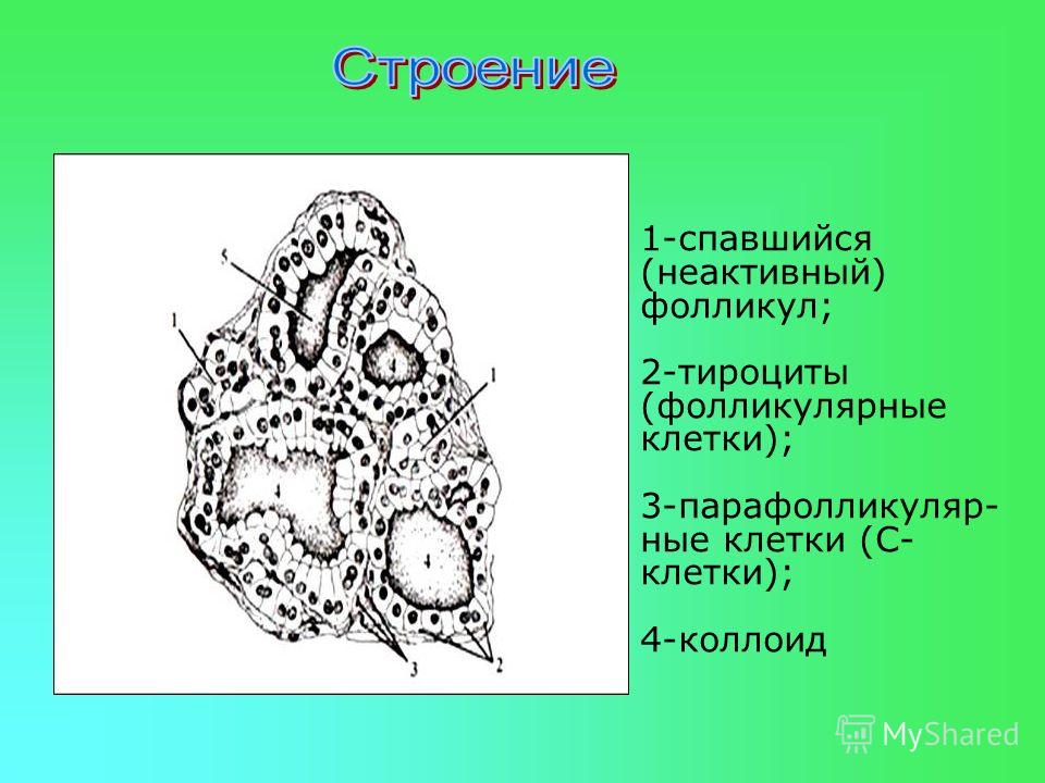 1-спавшийся (неактивный) фолликул; 2-тироциты (фолликулярные клетки); 3-парафолликуляр- ные клетки (С- клетки); 4-коллоид