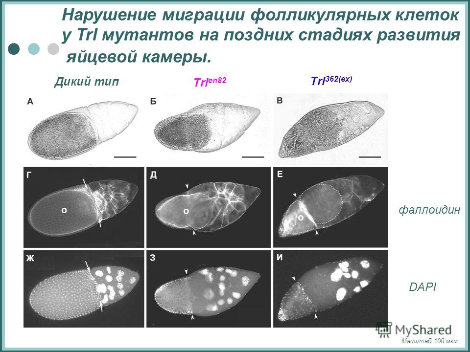 Нарушение миграции фолликулярных клеток у Trl мутантов на поздних стадиях развития яйцевой камеры. Масштаб 100 мкм. Дикий тип Trl en82 Trl 362(ex) DAPI фаллоидин