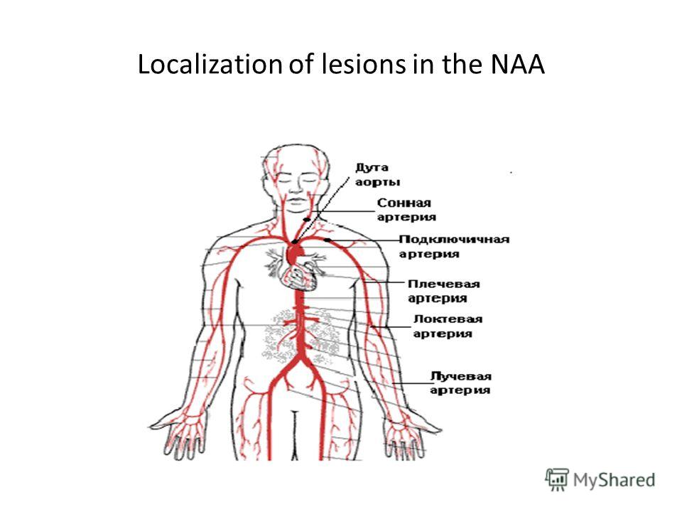 Localization of lesions in the NAA