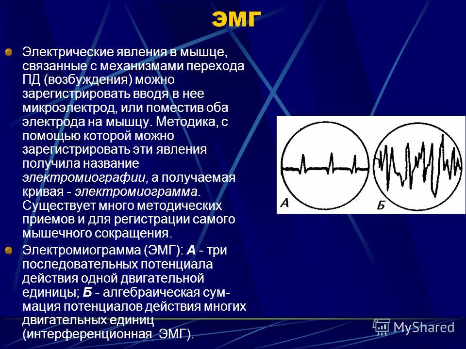 ЭМГ Электрические явления в мышце, связанные с механизмами перехода ПД (возбуждения) можно зарегистрировать вводя в нее микроэлектрод, или поместив оба электрода на мышцу. Методика, с помощью которой можно зарегистрировать эти явления получила назван