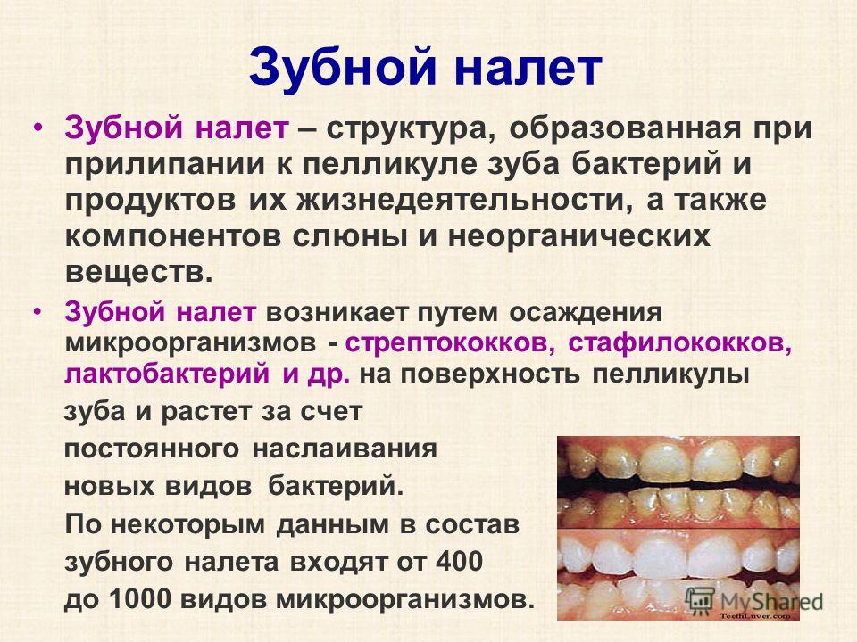 Зубной налет Зубной налет – структура, образованная при прилипании к пелликуле зуба бактерий и продуктов их жизнедеятельности, а также компонентов слюны и неорганических веществ. Зубной налет возникает путем осаждения микроорганизмов - стрептококков,