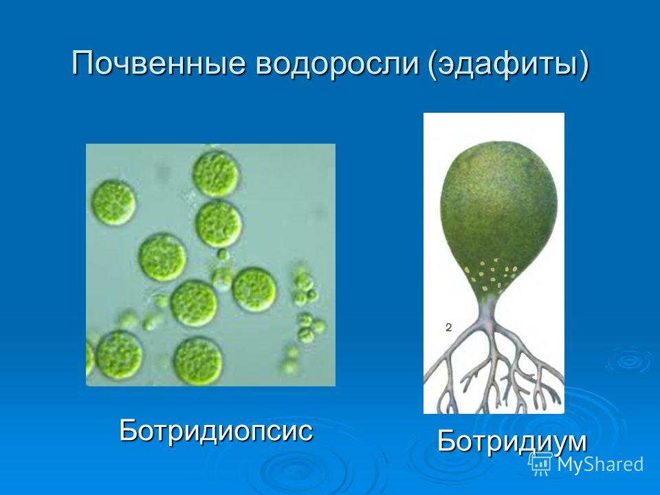 Почвенные водоросли (эдафиты) Ботридиум Ботридиопсис