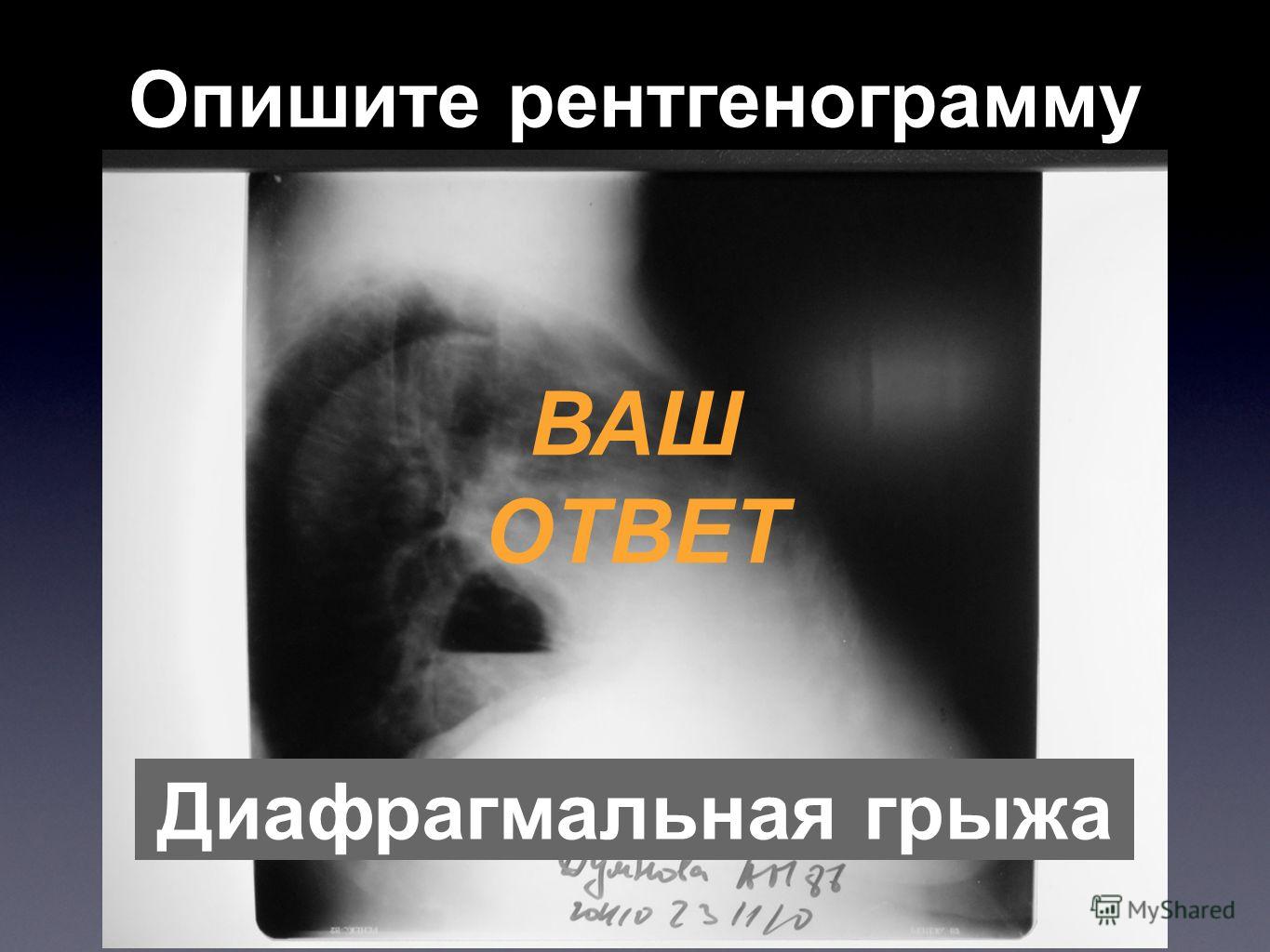 Диафрагмальная грыжа у собак