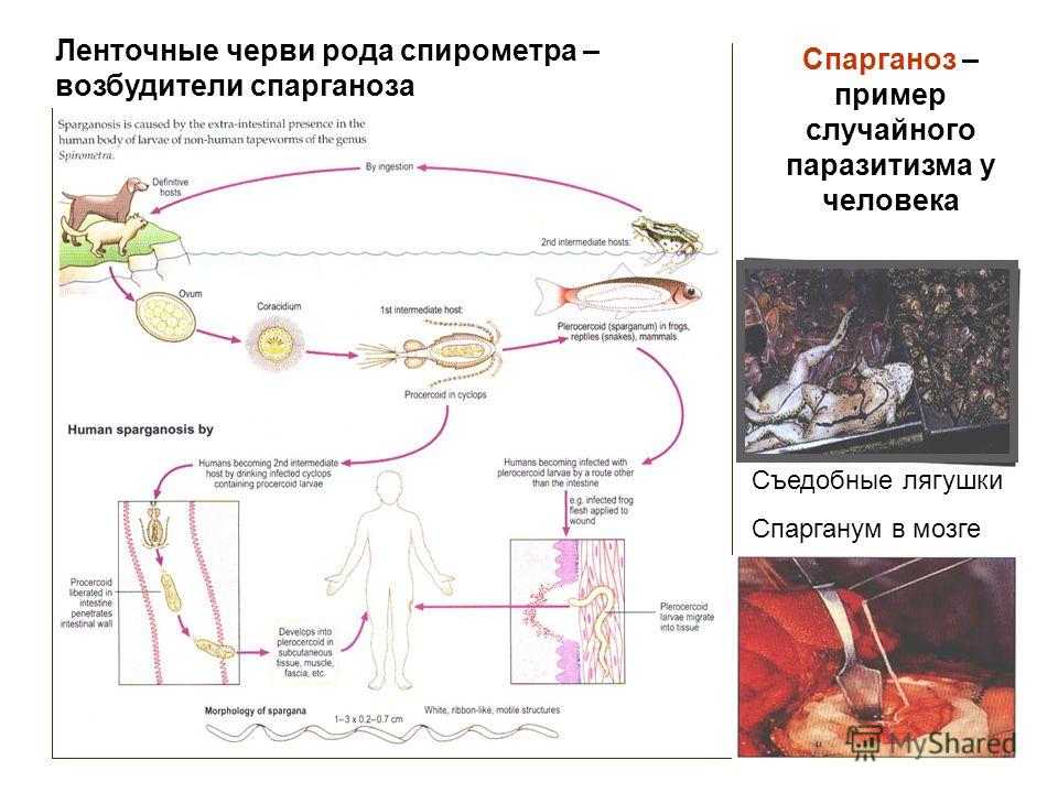 Спарганоз – пример случайного паразитизма у человека Съедобные лягушки Спарганум в мозге Ленточные черви рода спирометра – возбудители спарганоза