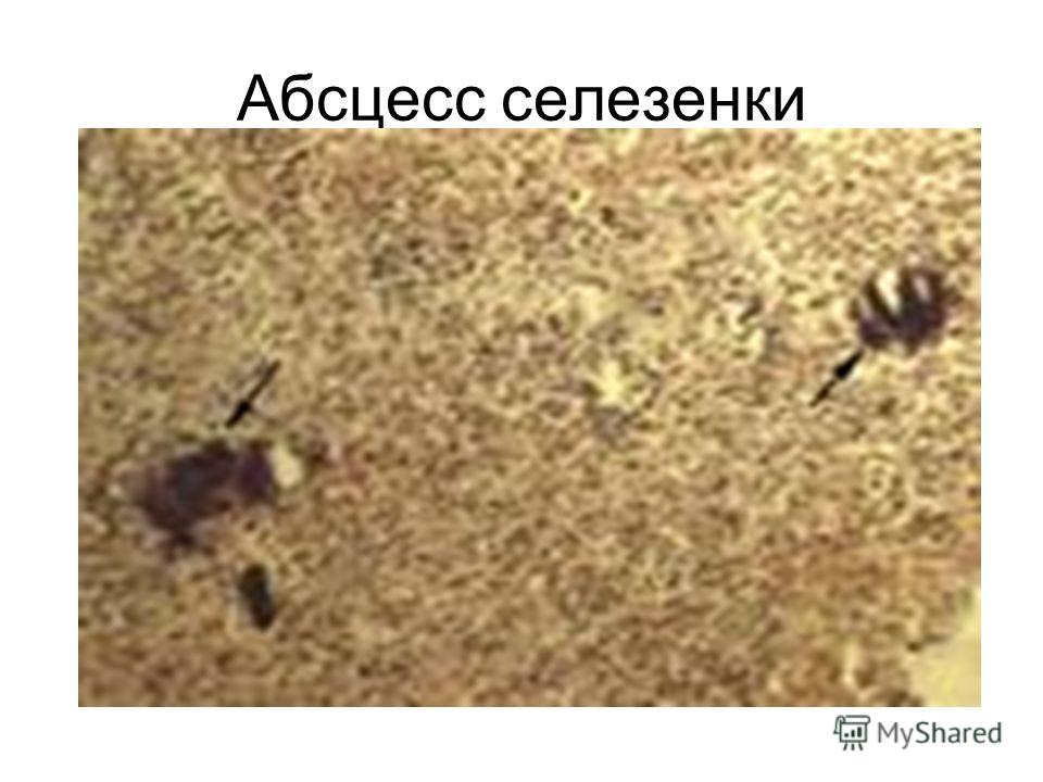 Лечение голоданием детей