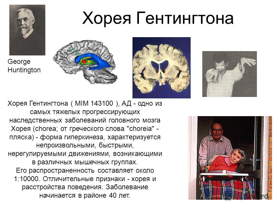 Хорея Гентингтона George Huntington Хорея Гентингтона ( MIM 143100 ), АД - одно из самых тяжелых прогрессирующих наследственных заболеваний головного мозга Хорея (chorea; от греческого слова 