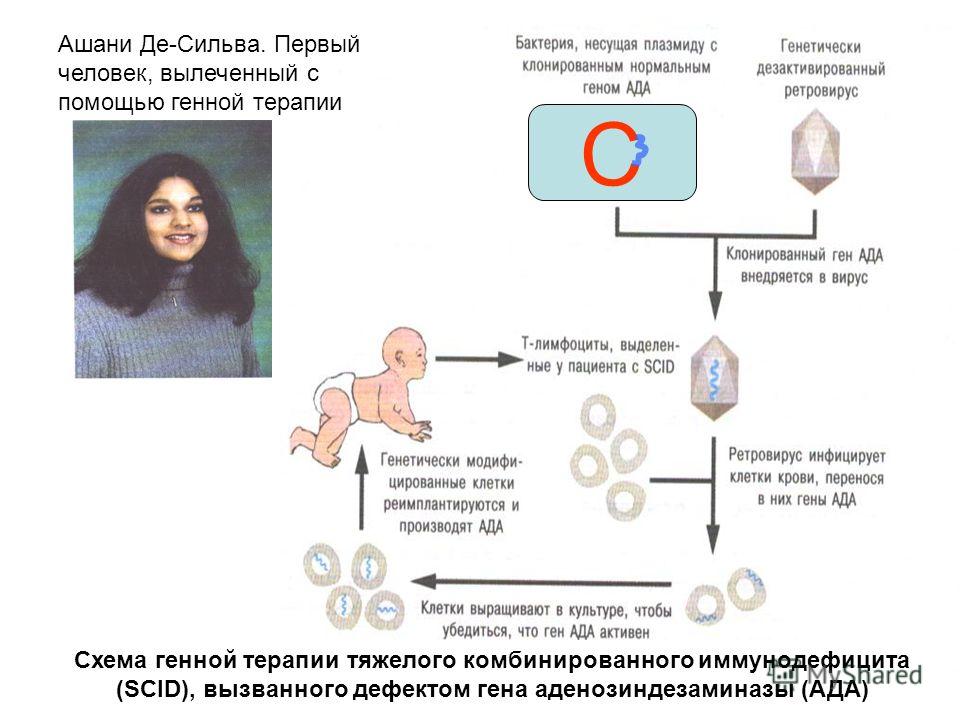 Схема генной терапии тяжелого комбинированного иммунодефицита (SCID), вызванного дефектом гена аденозиндезаминазы (АДА) Ашани Де-Сильва. Первый человек, вылеченный с помощью генной терапии C