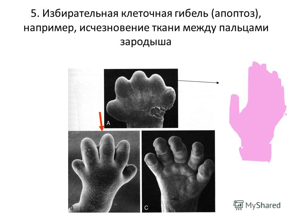 5. Избирательная клеточная гибель (апоптоз), например, исчезновение ткани между пальцами зародыша