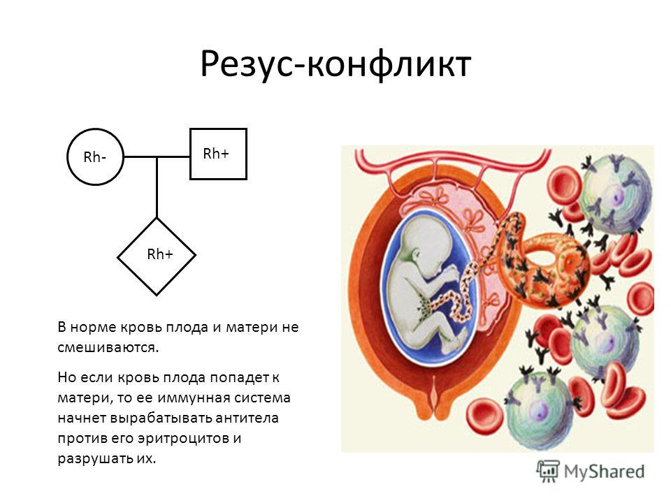 Резус-конфликт Rh- Rh+ В норме кровь плода и матери не смешиваются. Но если кровь плода попадет к матери, то ее иммунная система начнет вырабатывать антитела против его эритроцитов и разрушать их.