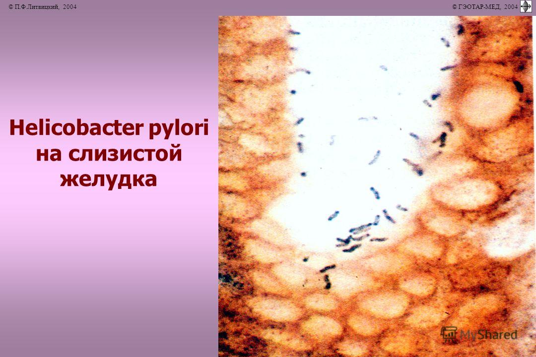 © П.Ф.Литвицкий, 2004 © ГЭОТАР-МЕД, 2004 Helicobacter pylori на слизистой желудка
