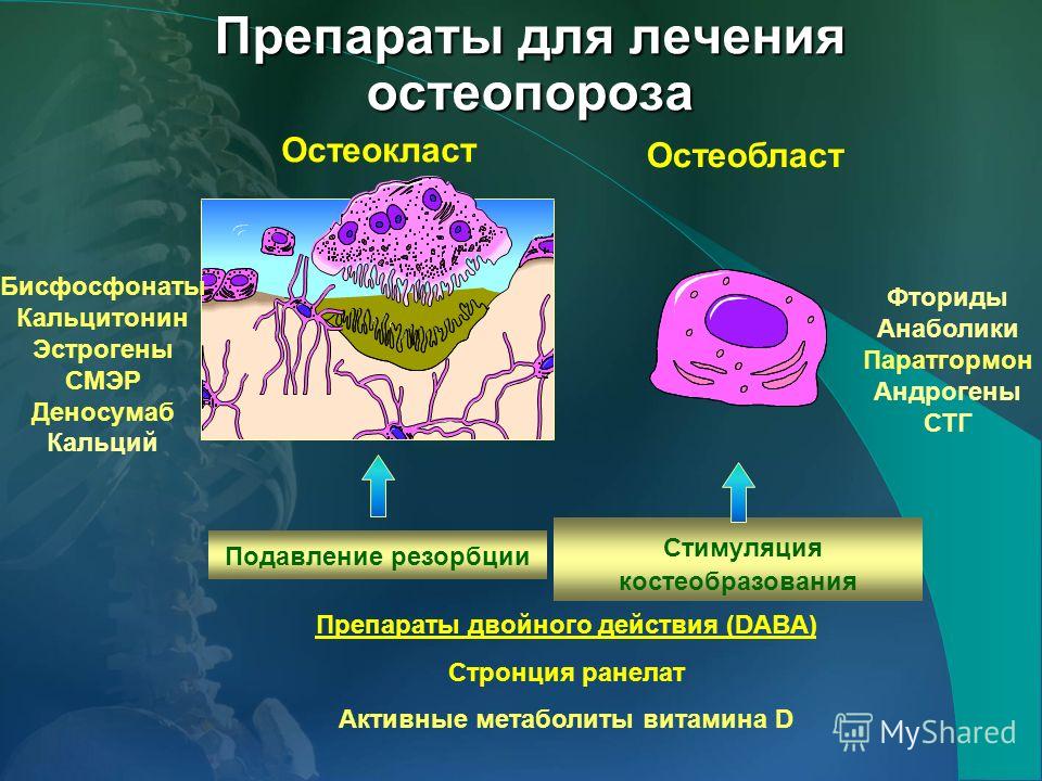 Презентация на тему: "Остеопороз: эпидемиология, диагностика ...
