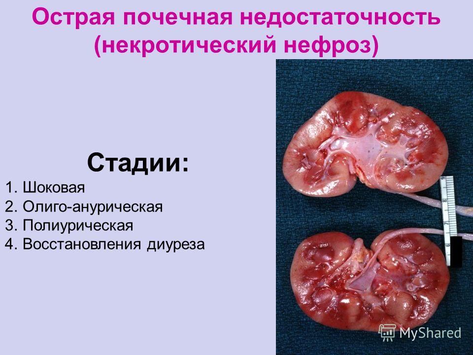 Как лечить почечную недостаточность у животных Как лечить почечную недостаточность у животных