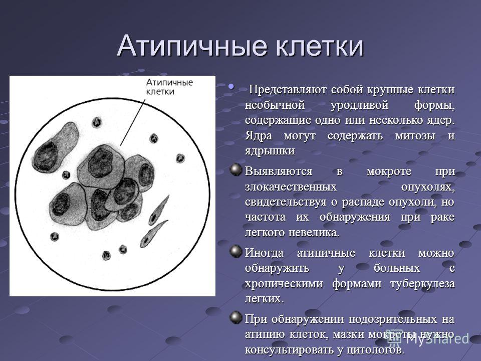 В гинекологии ключевые клетки