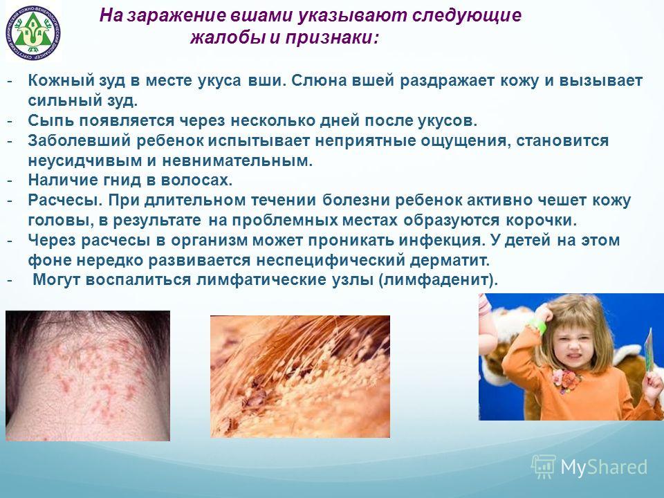 Все заболевания кожи фотографиями Все заболевания кожи фотографиями
