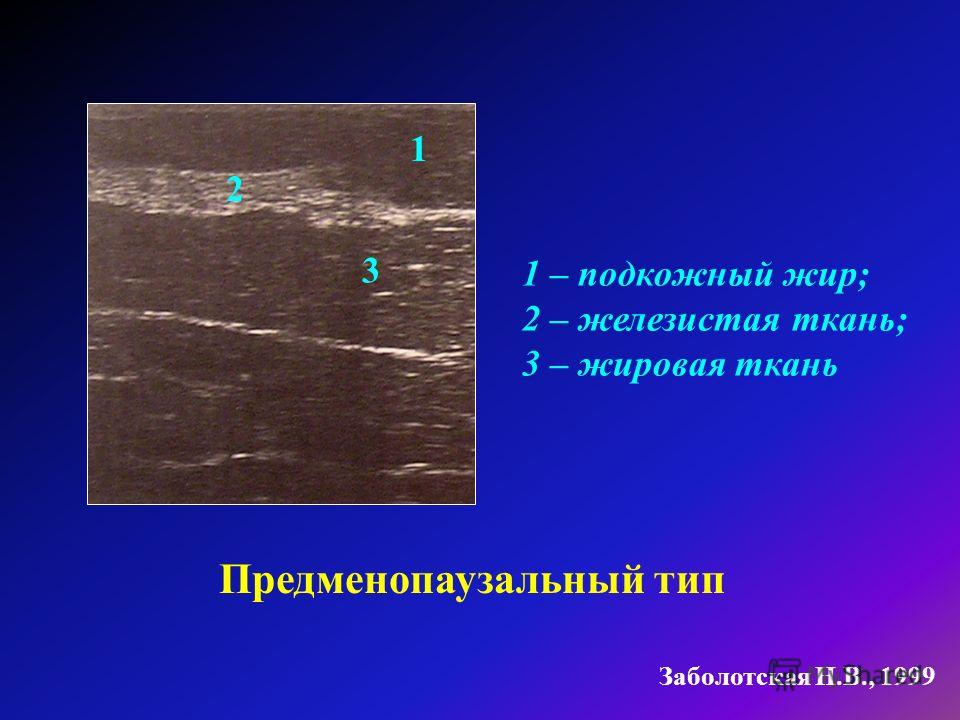 Как сделать узи молочной железы 165