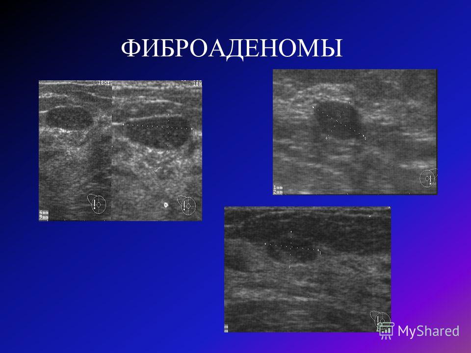Как берут сок простаты : подготовка и проведение анализа секрета К какому врачу обращаться при простатите, и в каких случаях?