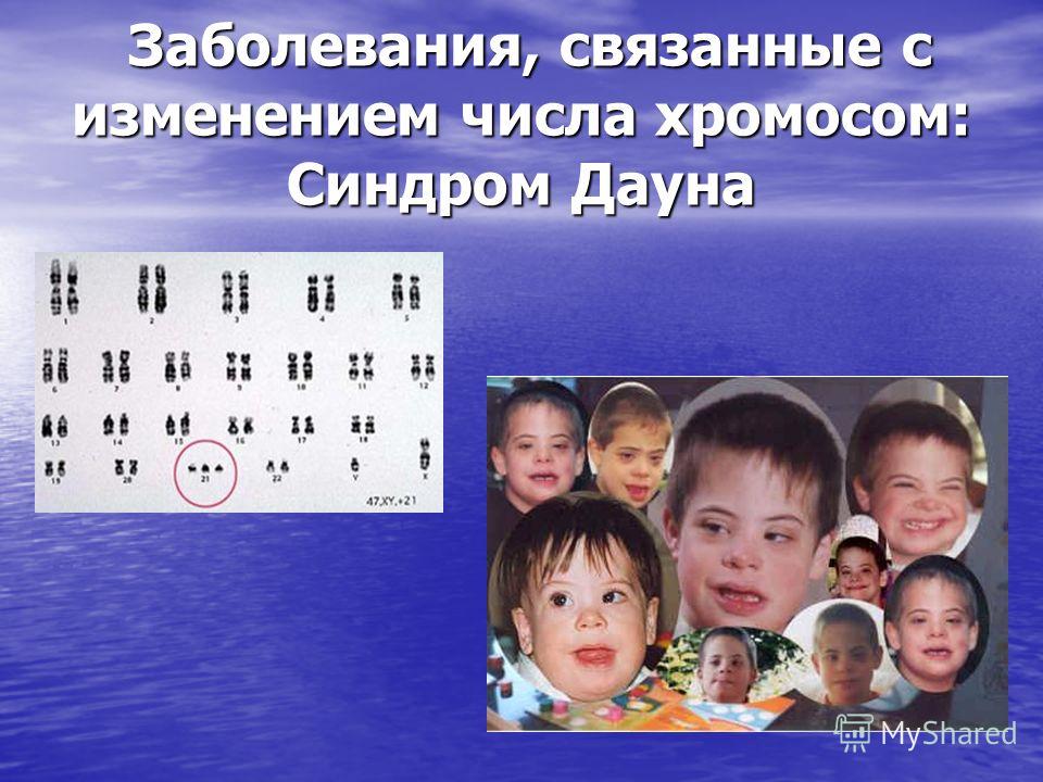 Болезни связаны с полом Болезни связаны с полом