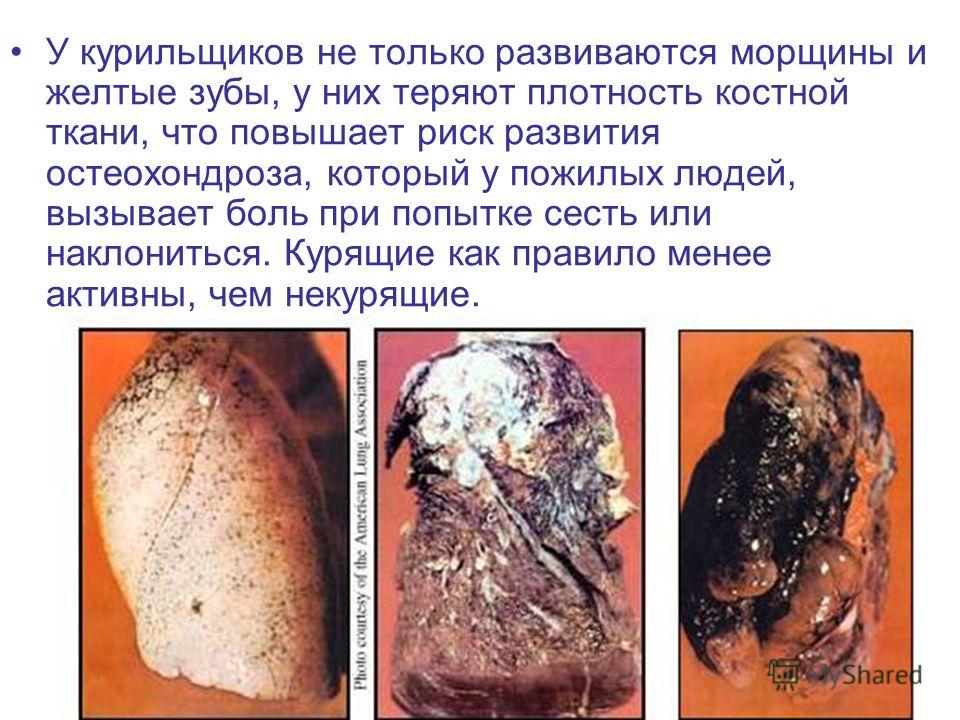 запах изо рта из под коронок запах изо рта из под коронок