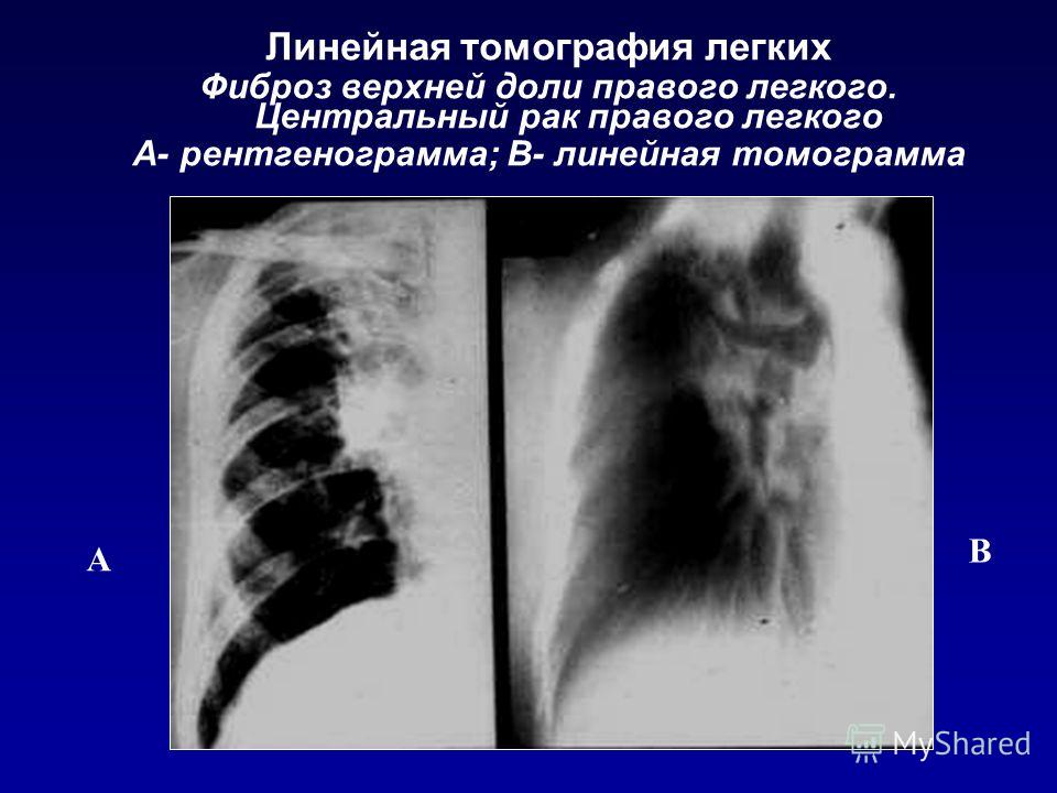 Кт легких клиника бгму Кт легких клиника бгму