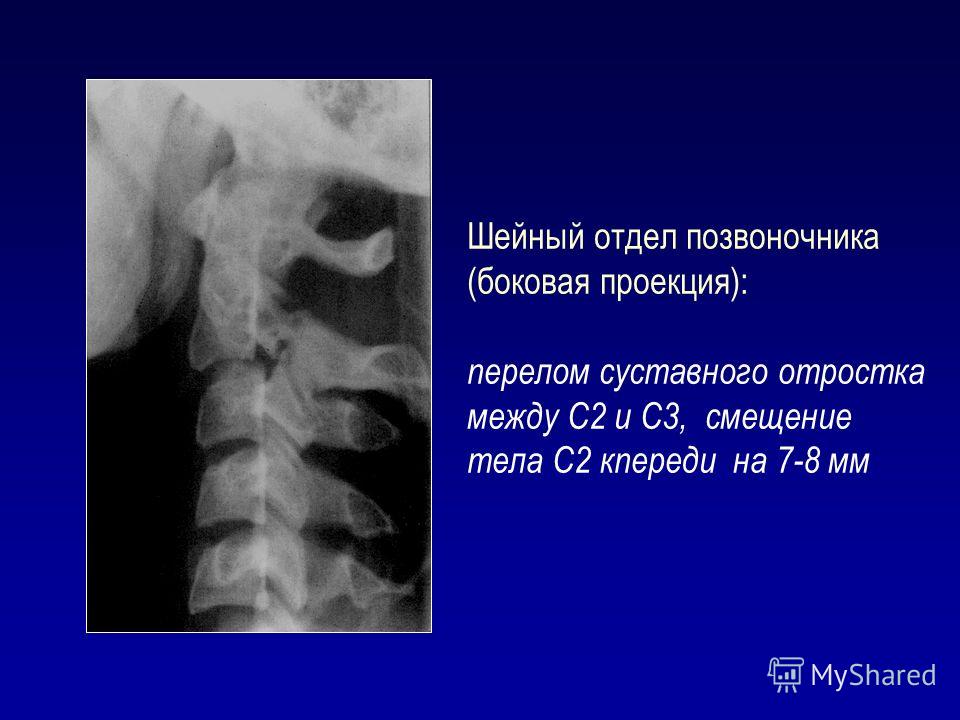 Диагноз шейного отдела Диагноз шейного отдела