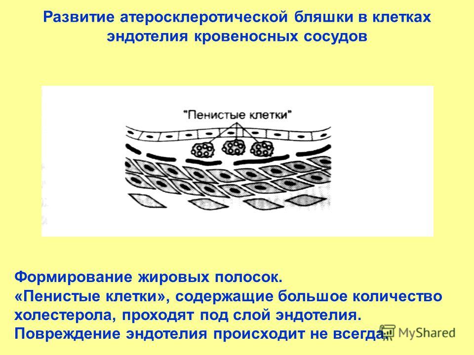 Чем снизить холестерин народное средство