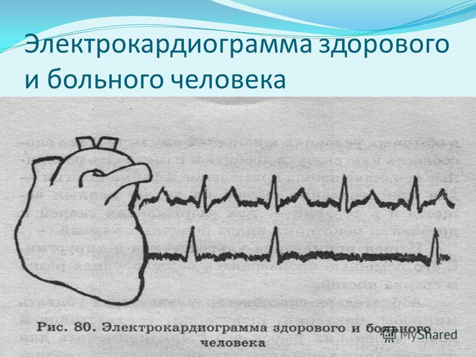 Ремонт экг
