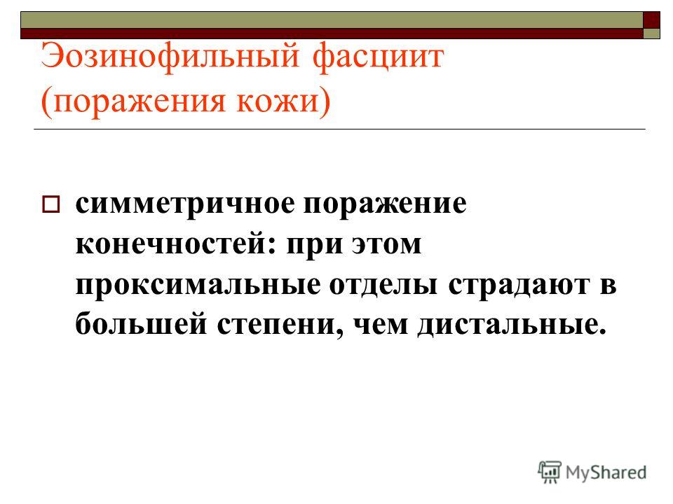 эозинофильный фасциит фото онлайн эозинофильный фасциит фото
