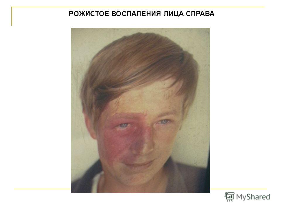 Лечение зубов под наркозом в магнитогорске