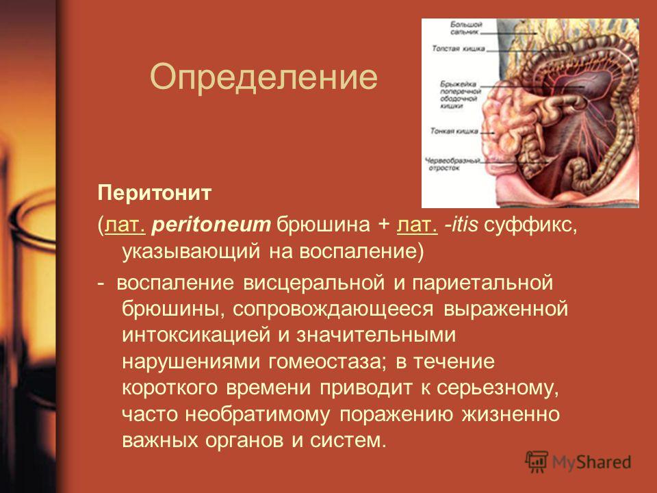 Реферат: Острый перитонит при гинекологических заболеваниях Реферат: Острый перитонит при гинекологических заболеваниях