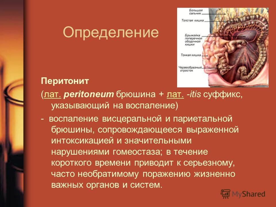 Реферат: Острый перитонит при гинекологических заболеваниях