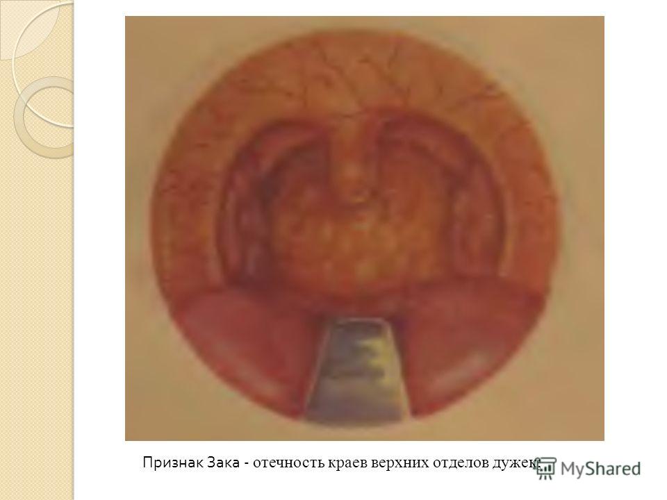 запах изо рта периодами запах изо рта периодами