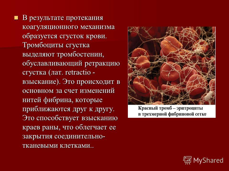 Наряд на свадьбу для мамы Наращивание ногтей в домашних условиях: учимся всем тонкостям