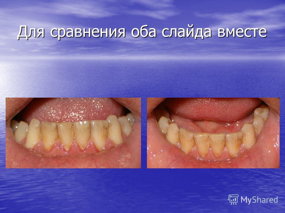 институт паразитологии лекарство от паразитов институт паразитологии лекарство от паразитов