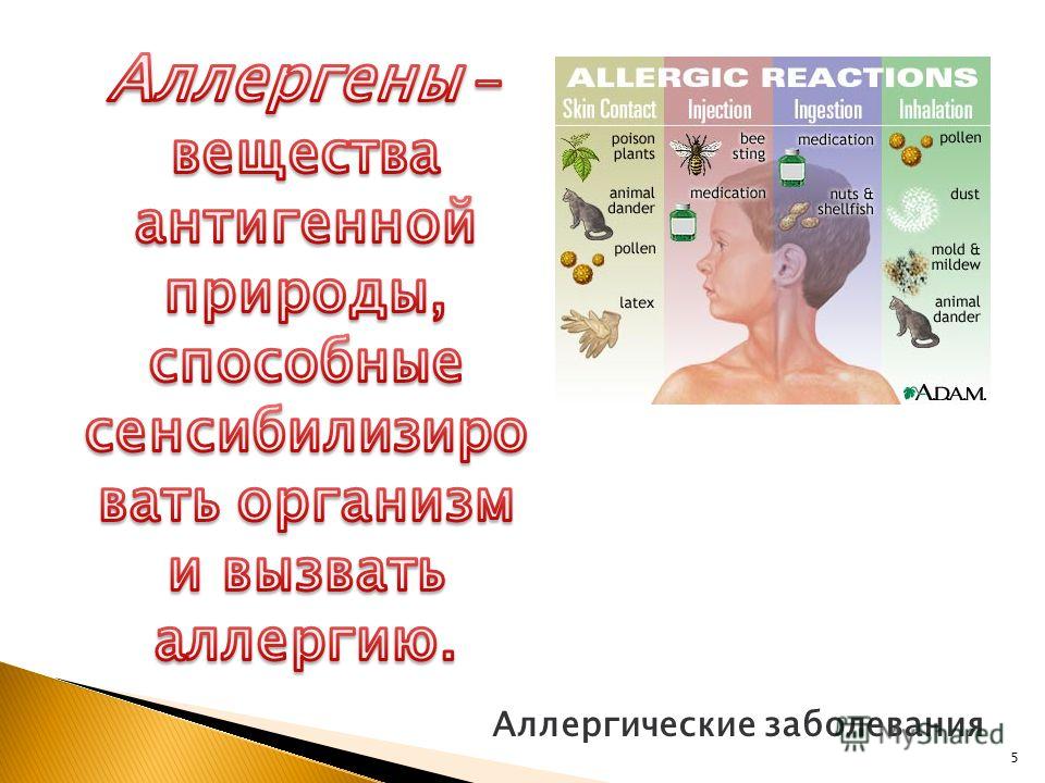 Аллергические заболевания 5