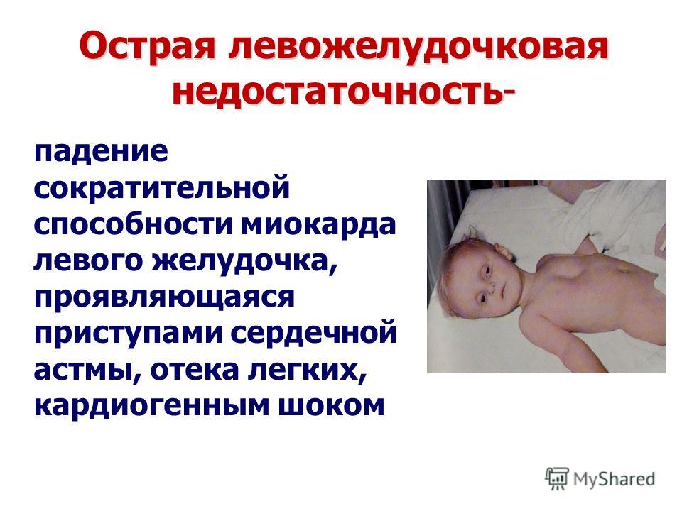 Как лечить непроходимость кишечника у собак Как лечить непроходимость кишечника у собак