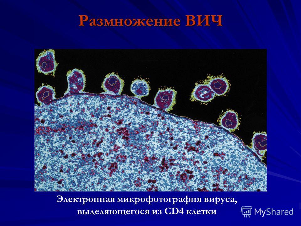 Размножение ВИЧ Электронная микрофотография вируса, выделяющегося из CD4 клетки
