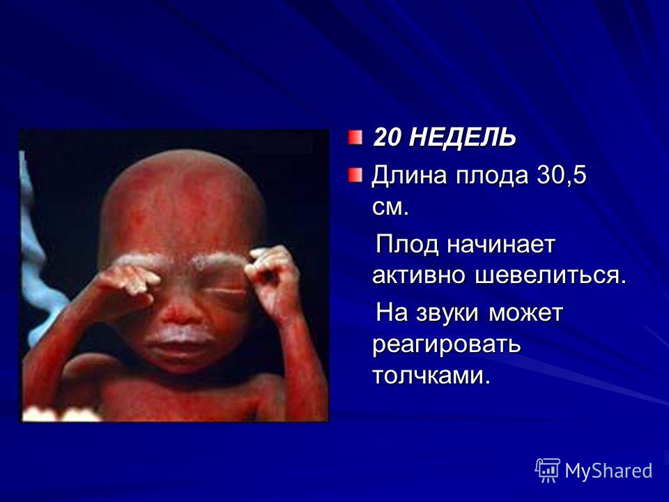 Плод ребенка 24 недели 32 Плод ребенка 24 недели 51