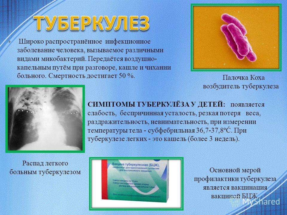 Первые месяц беременности болит поясница