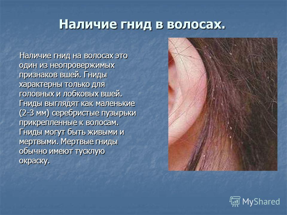 Был контакт с вшивым ребенком что делать 101