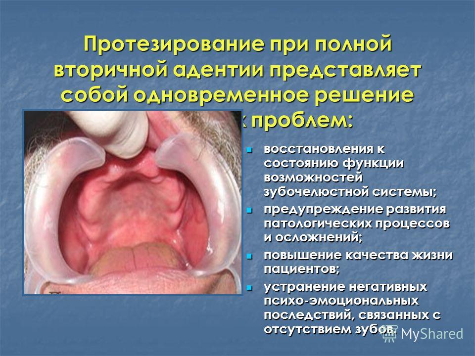 Модные куртки-пальто 2017 - modnaya. org Маникюр на короткие ногти 2017 идеи фото