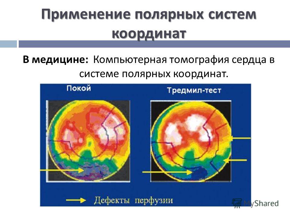 Презентация на тему: "Линейная функция и её график г x y -5 7 А А (-5;7)". Скача