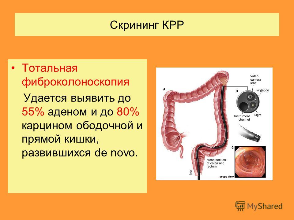 Удаление ворсинчатой аденомы Удаление ворсинчатой аденомы