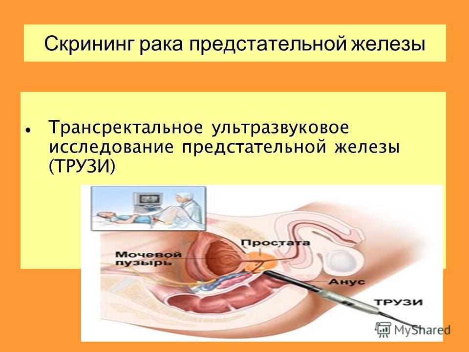 Трансректальное Узи Девственниц