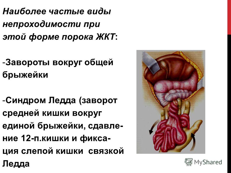 Диета После Заворота Кишок