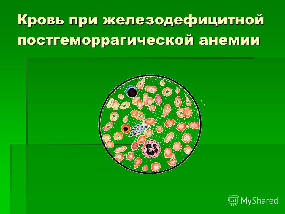 Симптомы - Кожные болезни Себорея: причины, симптомы, лечение