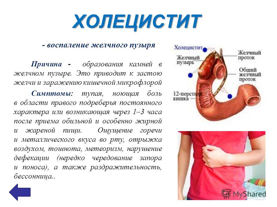 Презентация на тему: "БОЛЕЗНИ ЦИВИЛИЗАЦИИ МУНИЦИПАЛЬНОЕ АВТОНОМНОЕ ОБЩЕОБРАЗОВАТЕЛЬНОЕ УЧРЕЖДЕНИЕ СРЕДНЯЯ ОБЩЕОБРАЗОВАТЕЛЬНАЯ ШК